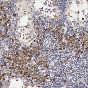 Anti-SLITRK4 antibody produced in rabbit HPA001039-100UL