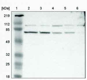 Anti-SLITRK4 antibody produced in rabbit HPA001039-100UL