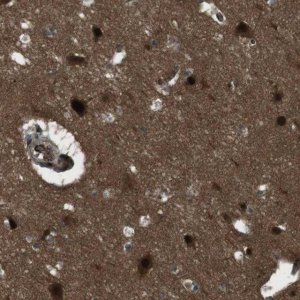 Anti-SLITRK5 antibody produced in rabbit 