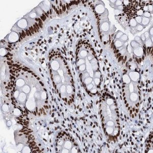 Anti-SLTM antibody produced in rabbit 