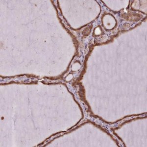Anti-SLX1A antibody produced in rabbit 