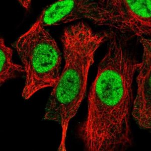 Anti-SLX1A antibody produced in rabbit 