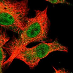 Anti-SLX4 antibody produced in rabbit 