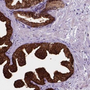 Anti-SMAD3 antibody produced in rabbit 