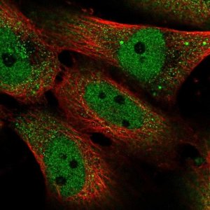 Anti-SMAD5 antibody produced in rabbit HPA058931-100UL