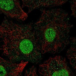 Anti-SMAD6 antibody produced in rabbit 
