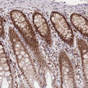 Anti-SMAD9 antibody produced in rabbit 