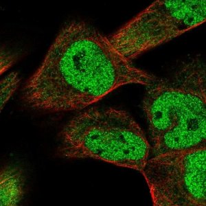 Anti-SMAD9 antibody produced in rabbit 