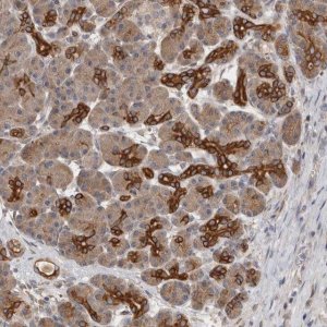 Anti-SMAP2 antibody produced in rabbit 