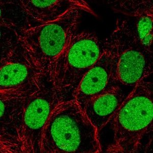 Anti-SMARCC2 antibody produced in rabbit 