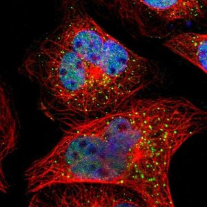 Anti-SMARCD1 antibody produced in rabbit 