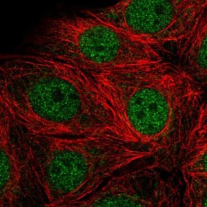 Anti-SMARCD2 antibody produced in rabbit 