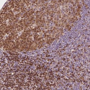 Anti-SMC2 antibody produced in rabbit HPA071309-100UL