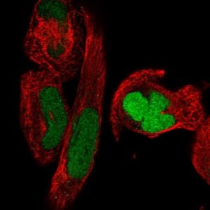 Anti-SMC2 antibody produced in rabbit HPA071309-100UL