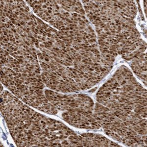 Anti-SMC3 antibody produced in rabbit HPA037411-100UL