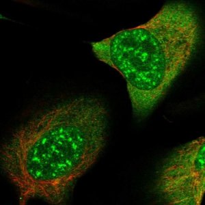 Anti-SMC4 antibody produced in rabbit 