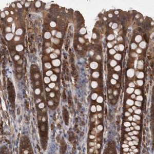Anti-SMCR8 antibody produced in rabbit 