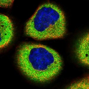 Anti-SMG7 antibody produced in rabbit 