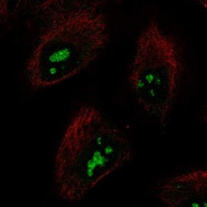 Anti-SMKR1 antibody produced in rabbit 