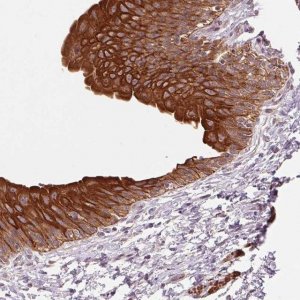 Anti-SMLR1 antibody produced in rabbit 