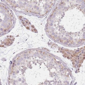 Anti-SMPD4 antibody produced in rabbit 