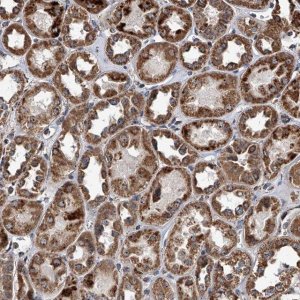 Anti-SMPDL3A antibody produced in rabbit HPA030148-100UL