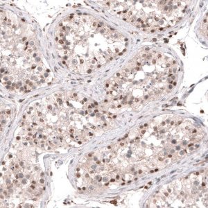 Anti-SMYD2 antibody produced in rabbit 