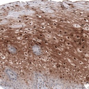 Anti-SMYD2 antibody produced in rabbit 
