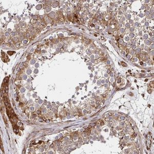 Anti-SMYD3 antibody produced in rabbit 