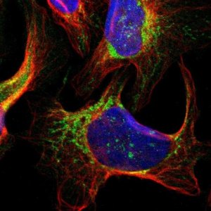 Anti-SMYD5 antibody produced in rabbit 