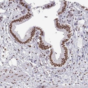 Anti-SNAI1 antibody produced in rabbit 
