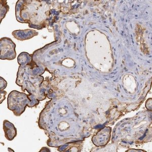 Anti-SNAP23 antibody produced in rabbit 