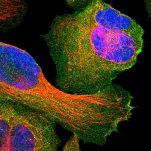 Anti-SNAP23 antibody produced in rabbit 