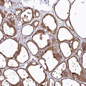 Anti-SNED1 antibody produced in rabbit 
