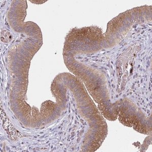 Anti-SNF8 antibody produced in rabbit 