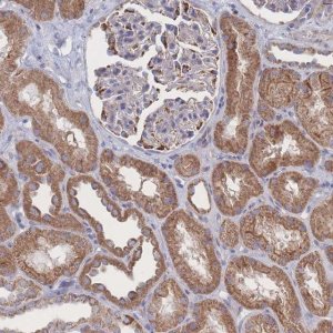 Anti-SNPH antibody produced in rabbit 
