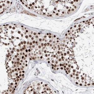 Anti-SNRNP200 antibody produced in rabbit 