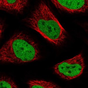 Anti-SNRNP200 antibody produced in rabbit 