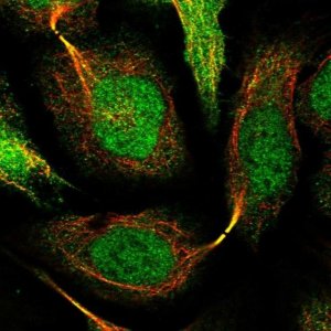 Anti-SNRNP25 antibody produced in rabbit 
