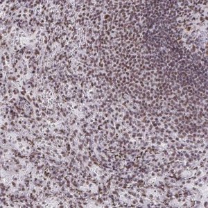 Anti-SNRNP70 antibody produced in rabbit 