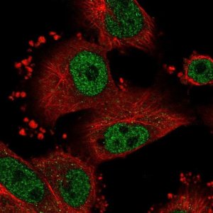Anti-SNRNP70 antibody produced in rabbit 