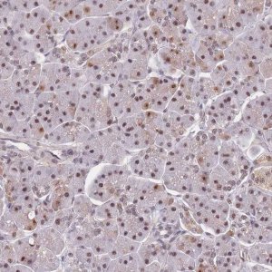 Anti-SNRPA1 antibody produced in rabbit 
