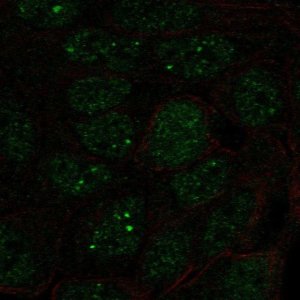 Anti-SNRPA1 antibody produced in rabbit 