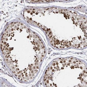 Anti-SNRPC antibody produced in rabbit 