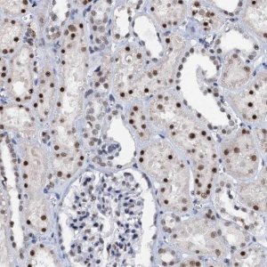 Anti-SNRPD1 antibody produced in rabbit 