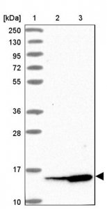 Anti-SNRPD1 antibody produced in rabbit 