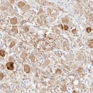 Anti-SNTB1 antibody produced in rabbit 