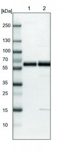 Anti-SNTB2 antibody produced in rabbit HPA001394-100UL