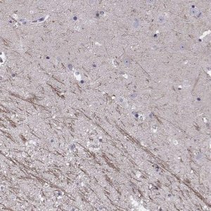 Anti-SNTG1 antibody produced in rabbit 