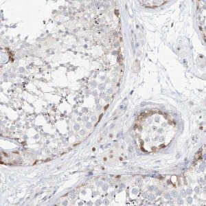 Anti-SNU13 antibody produced in rabbit 